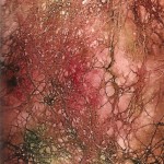 Second Place, Sue Stewart, Caladium Chaos, Acrylic Ink & Colored Pencil